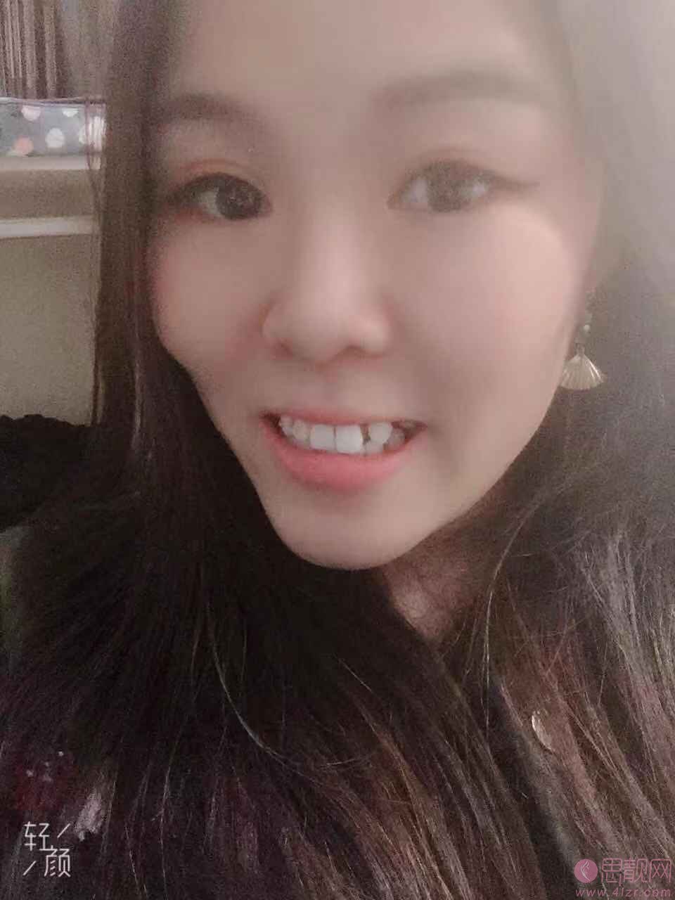 永华口腔矫正.种植.修复联合中心2020价格表全新上线+牙齿矫正案例前后对比案例