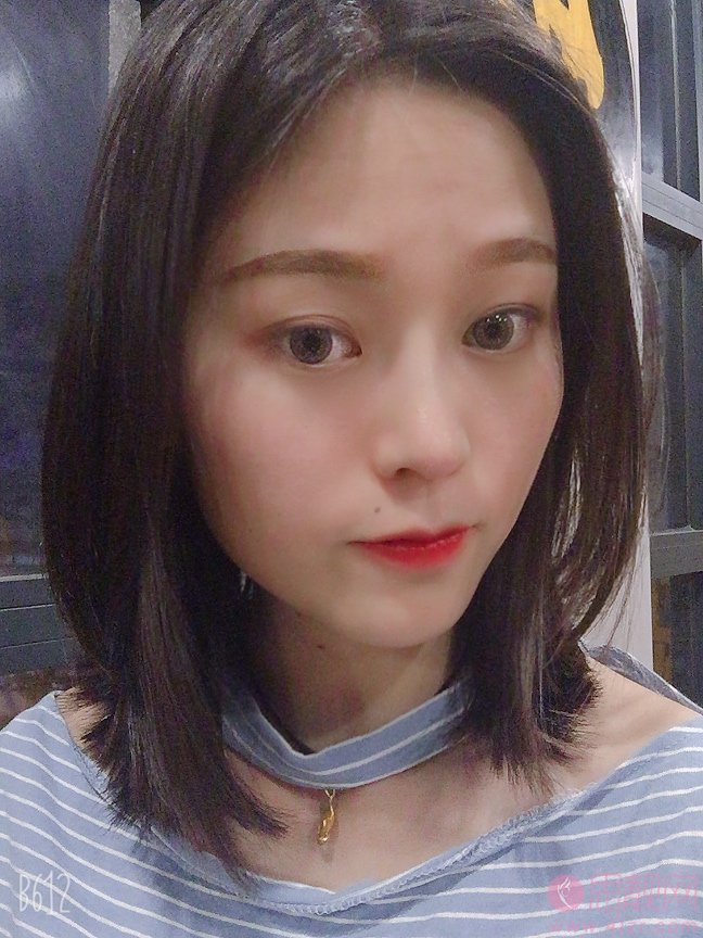 北京蜜邦医疗美容栾志宏隆鼻好不好？附隆鼻案例前后对比及2020价格表曝光