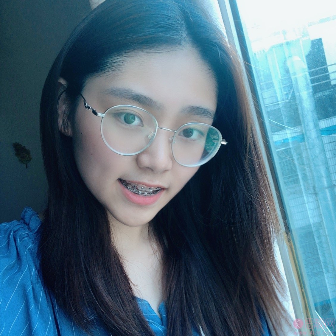 重庆瑞泰口腔医院张瑞晶牙齿矫正怎么样？2020价格表曝光+矫正案例前后对比
