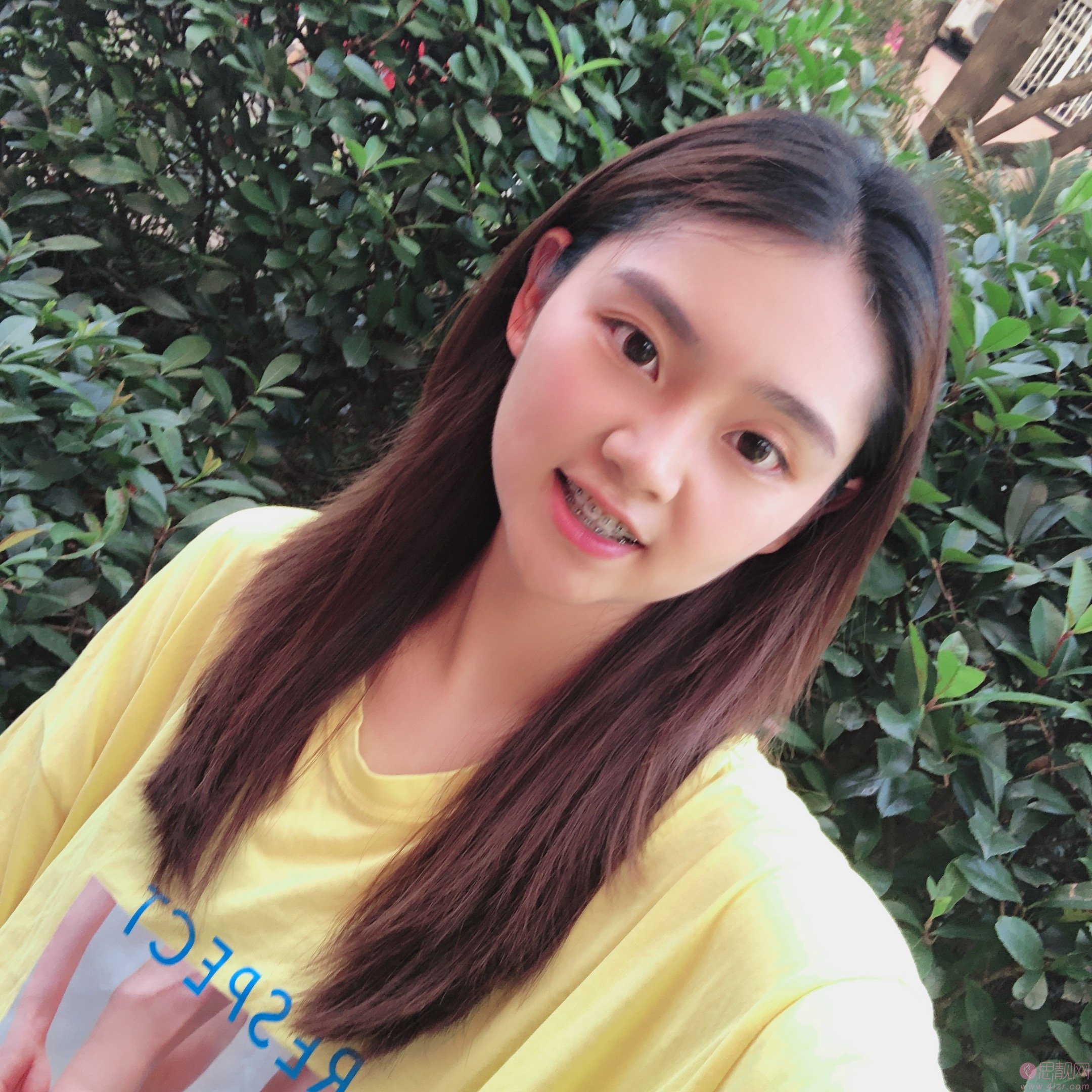 重庆瑞泰口腔医院张瑞晶牙齿矫正怎么样？2020价格表曝光+矫正案例前后对比