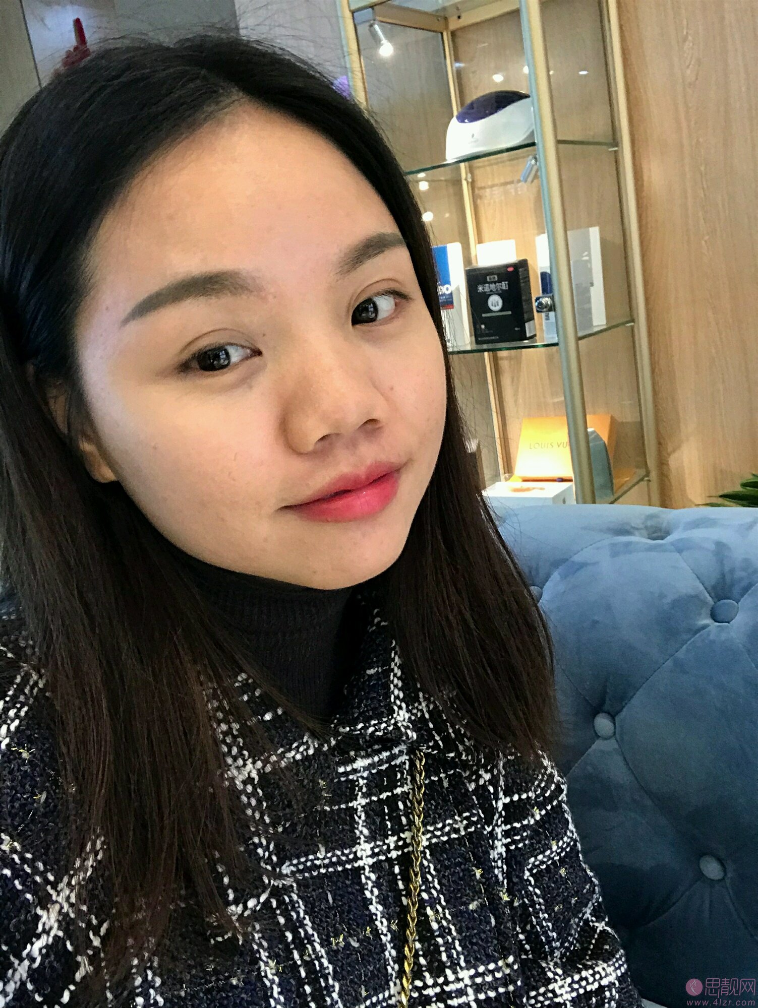 南宁悦星医疗美容连锁钟贵红隆鼻怎么样？附隆鼻效果展示及2020价格表曝光
