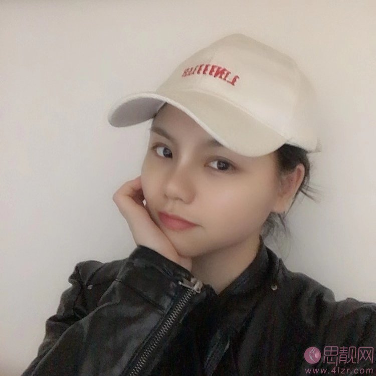 南宁悦星医疗美容连锁钟贵红隆鼻怎么样？附隆鼻效果展示及2020价格表曝光