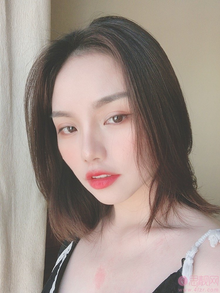 南宁悦星医疗美容连锁钟贵红隆鼻怎么样？附隆鼻效果展示及2020价格表曝光