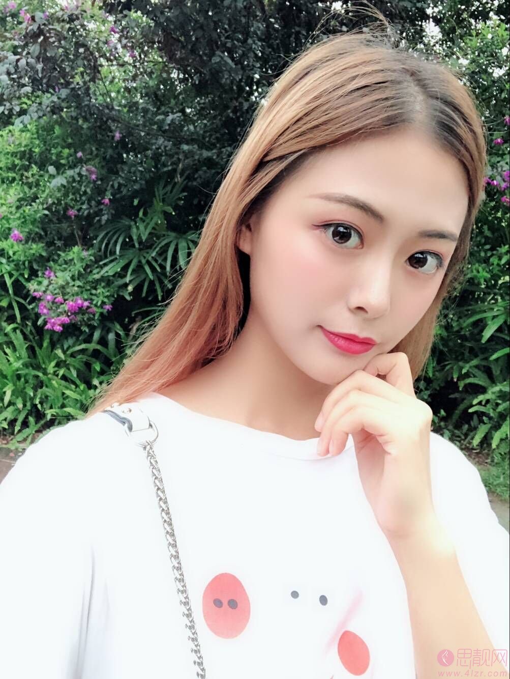 佛山顺德壹加壹医疗美容整形医院肖鹏隆鼻怎么样？附隆鼻案例展示及2020价格表一览