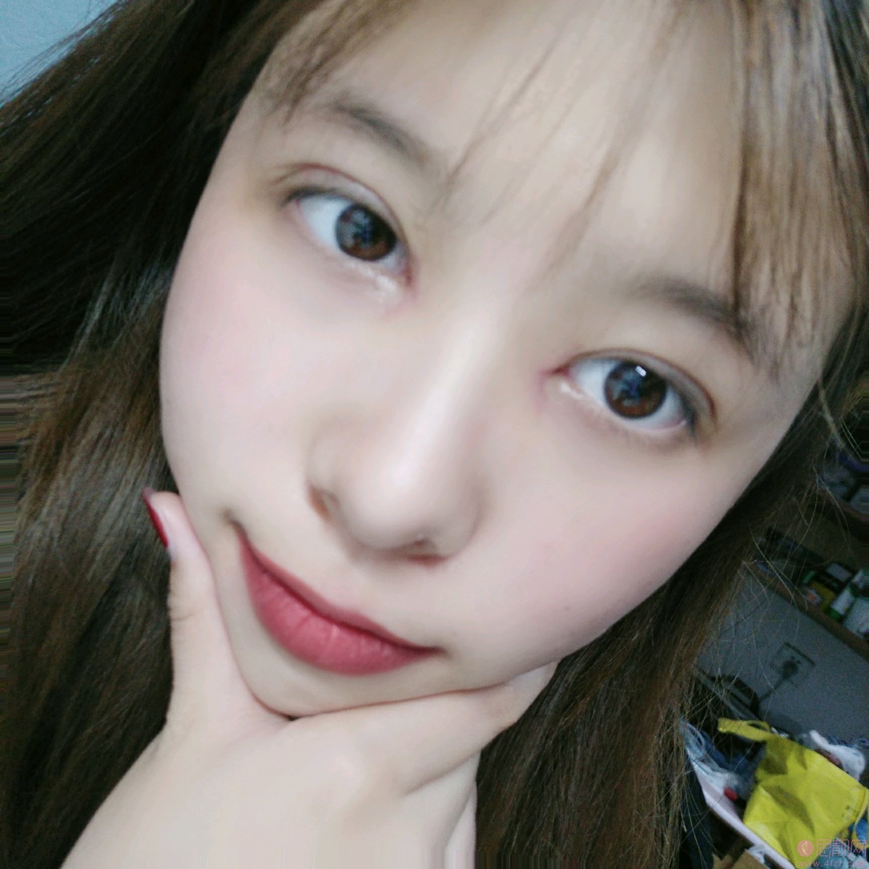 华中科技大学同济医学院医院整形美容陈平医生做双眼皮怎么样/2020价格表曝光