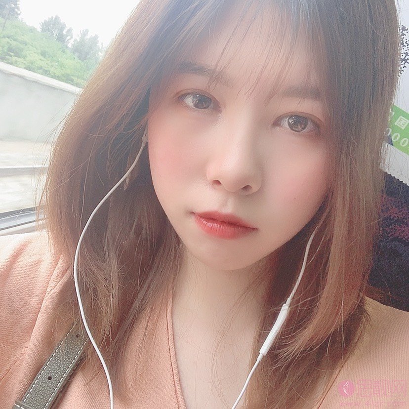 华中科技大学同济医学院医院整形美容陈平医生做双眼皮怎么样/2020价格表曝光