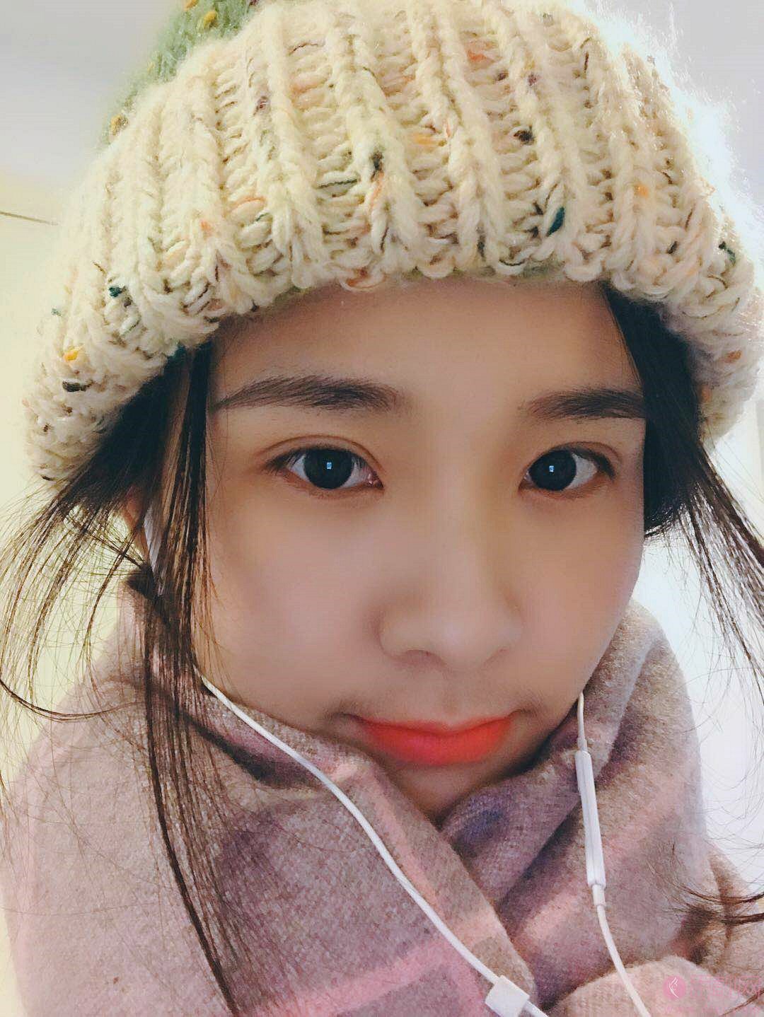 红颜拜博医疗美容闫家峰做双眼皮修复怎么样?附修复案例及2020价格表全新上线