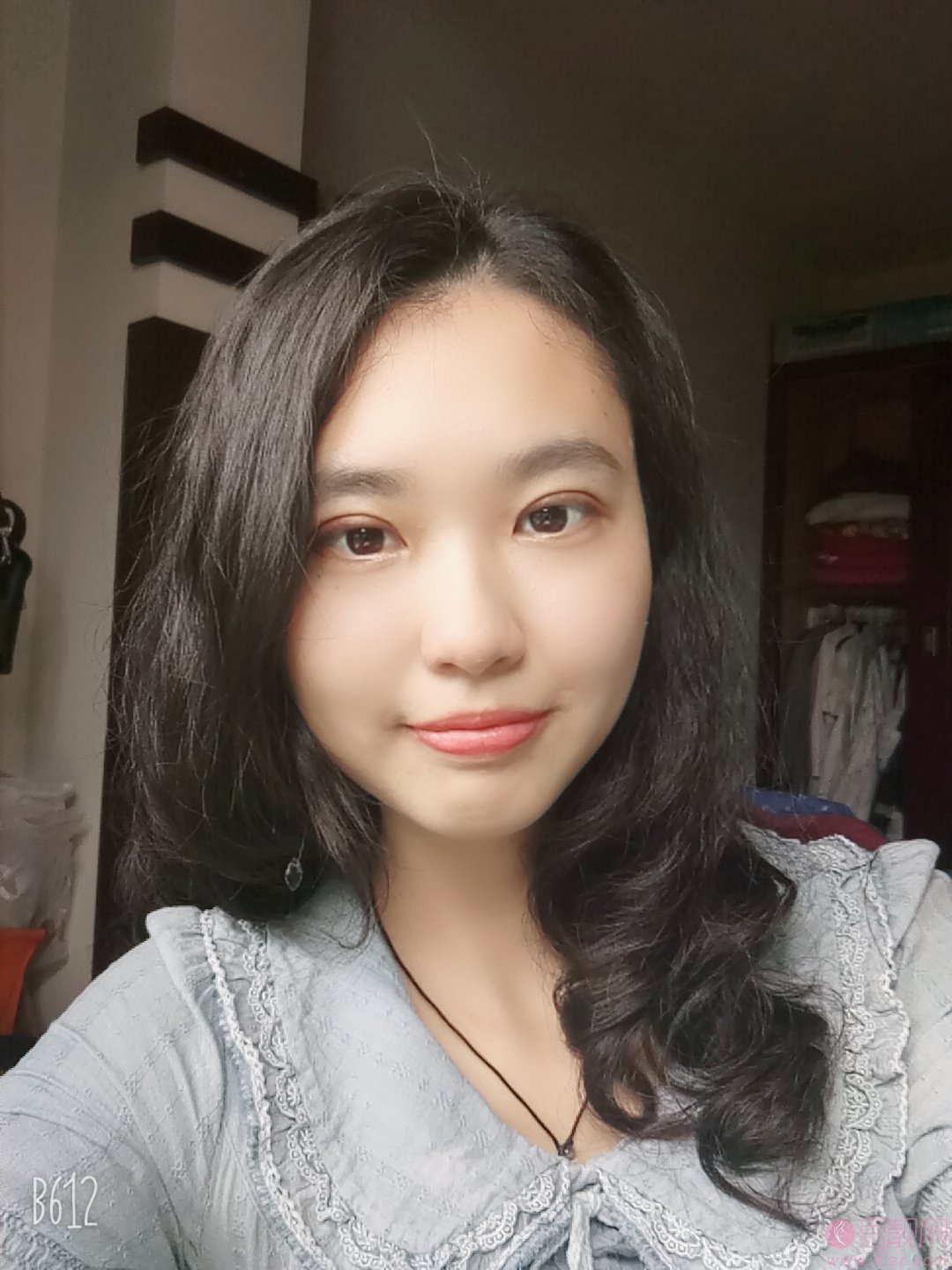 北京华韩整形医院谢立宁做双眼皮好不好？附双眼皮案例及2020价格表曝光
