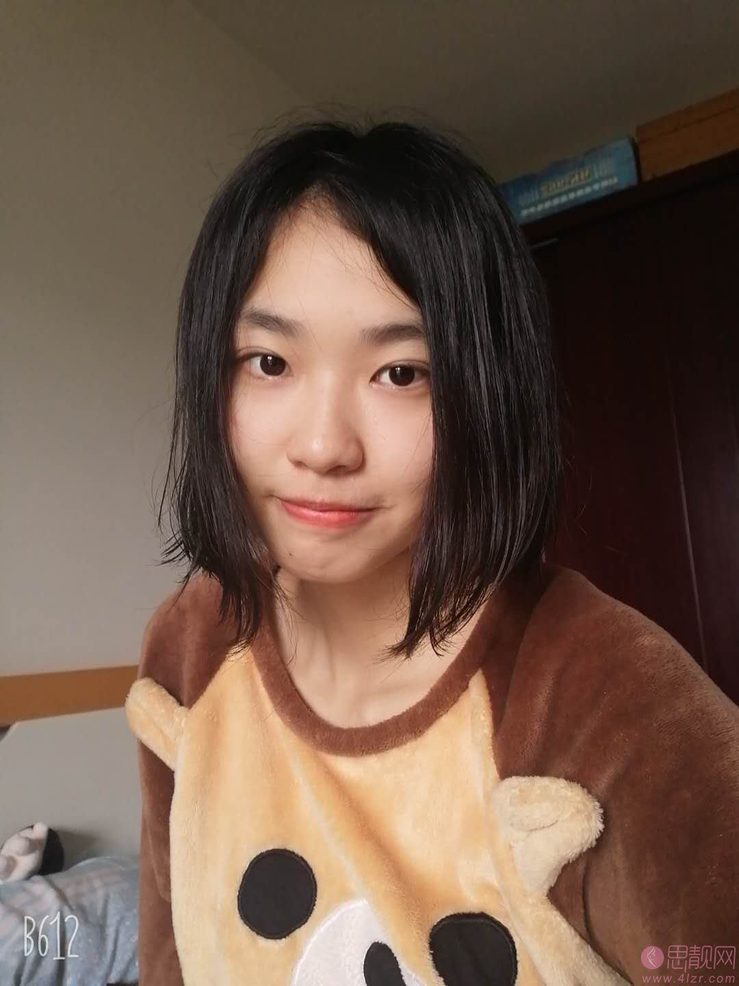 北京华韩整形医院谢立宁做双眼皮好不好？附双眼皮案例及2020价格表曝光