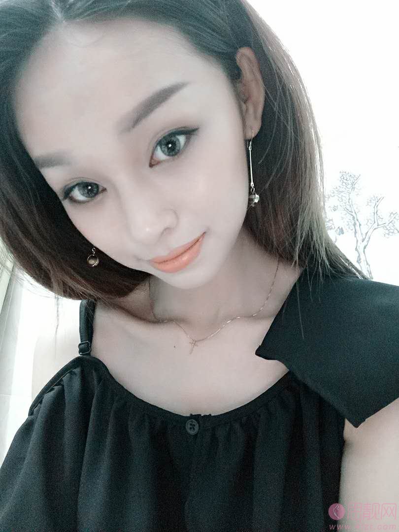 南阳三院医疗美容科隆鼻怎么样？附隆鼻真人案例分享及2020价格表一览