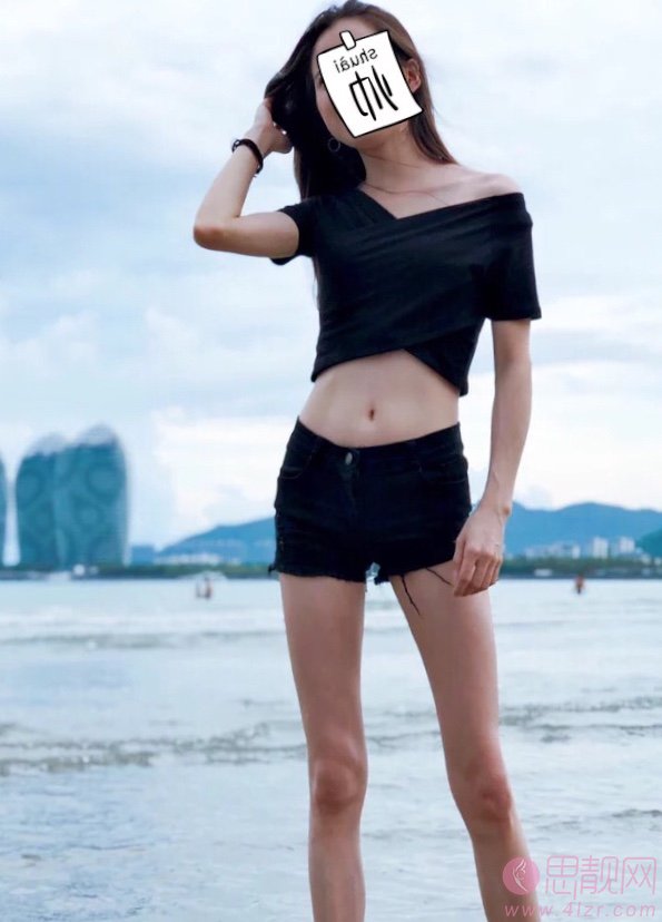 昭通爱丽诺医疗整形医院吸脂瘦腰部怎么样？2020价格表全新上线