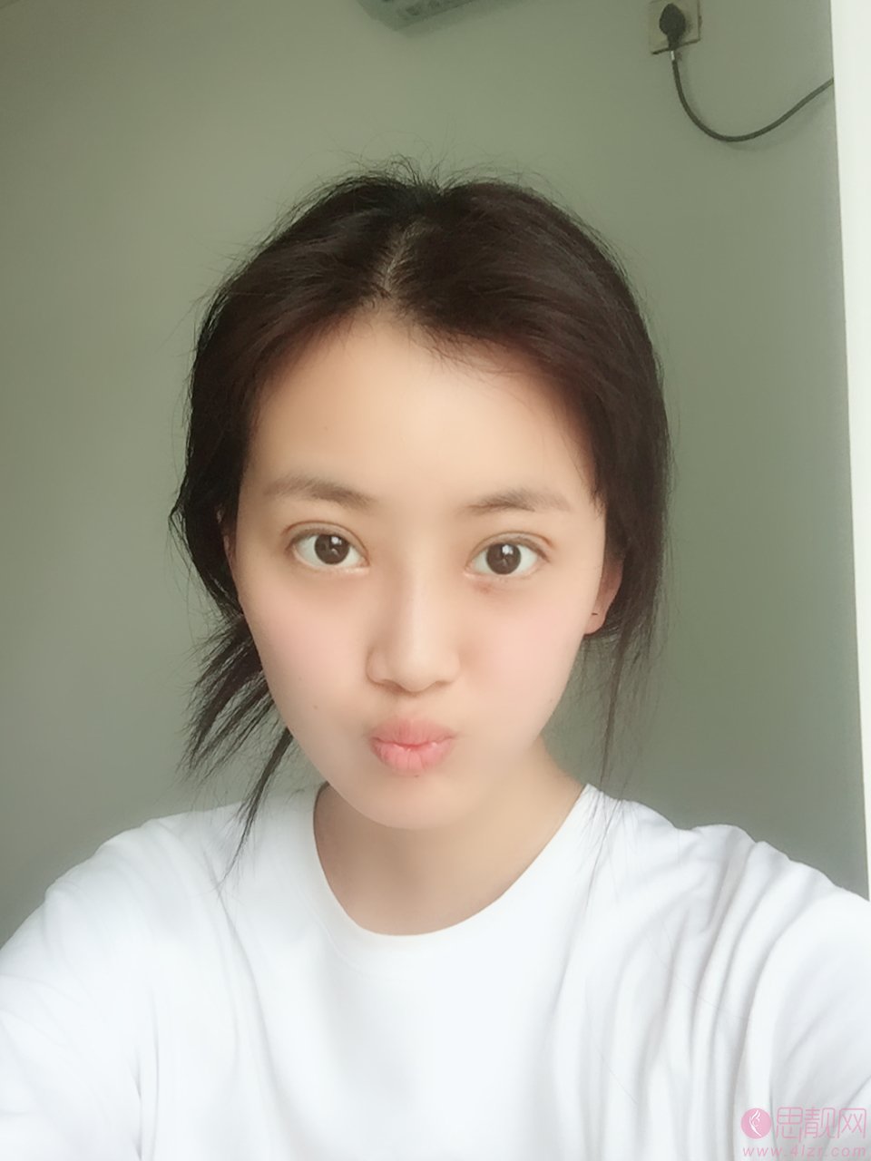 长沙青和医疗美容彭青和做双眼皮怎么样？2020价格表全新上线+双眼皮案例一览