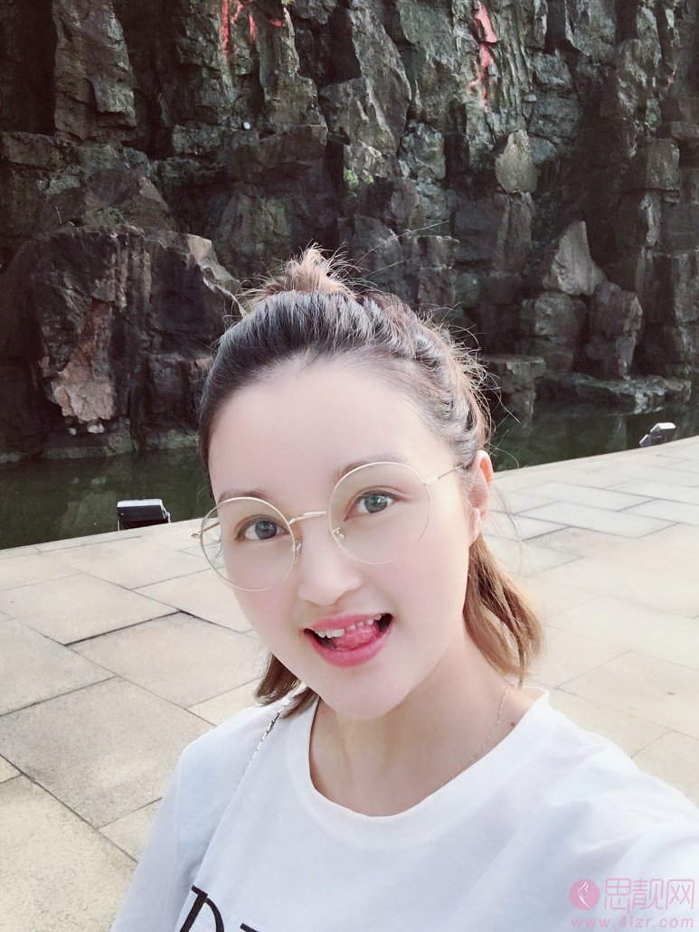 上海安缦医疗美容严彪做双眼皮怎么样？附双眼皮案例一览及2020价格表曝光
