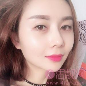 成都百龄驻颜医学美容自体脂肪全脸填充怎么样？2020价格表上线
