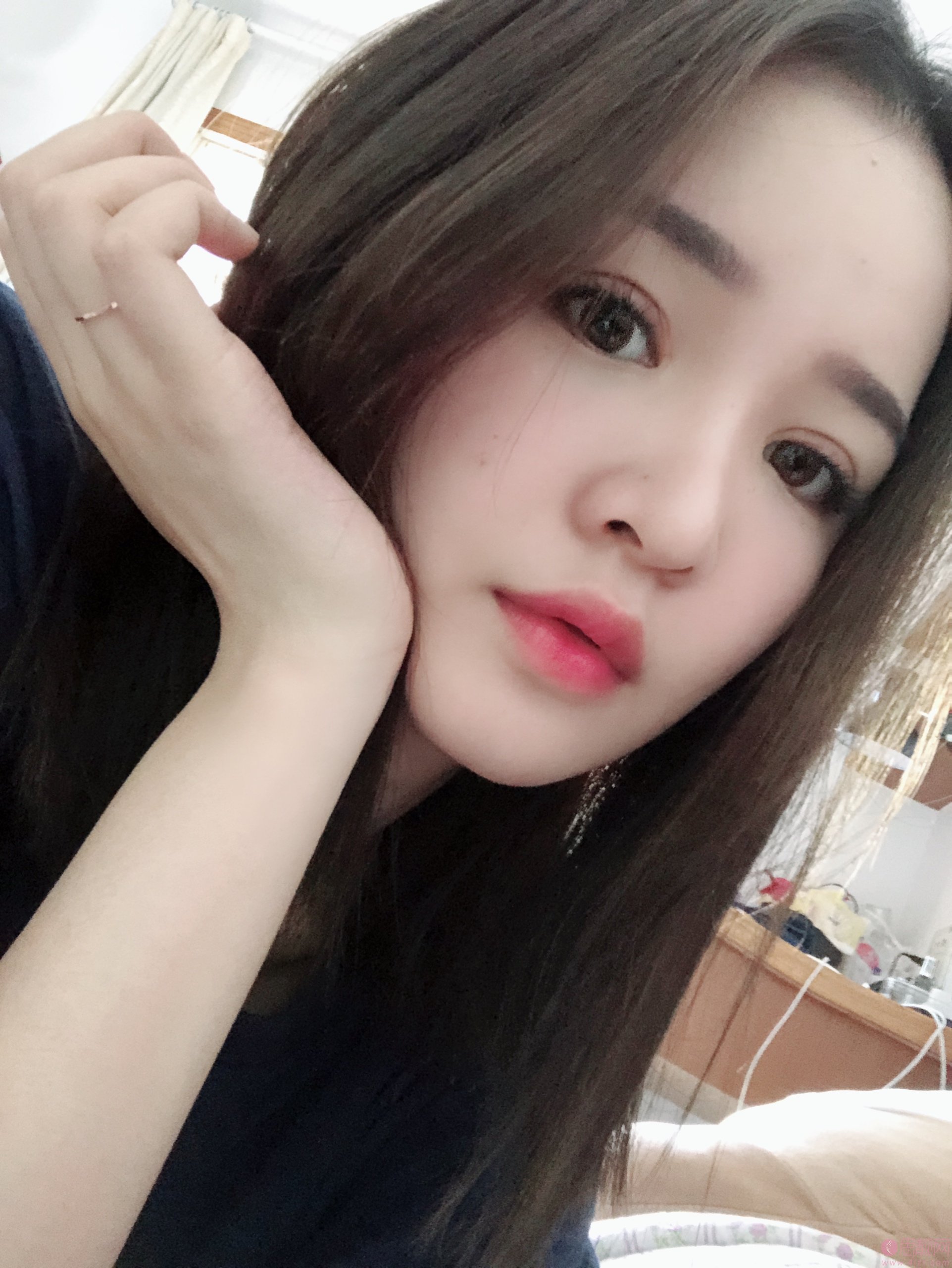 上海复旦大学附属华东医院做双眼皮怎么样？附双眼皮真人案例分享及2020价格表上线