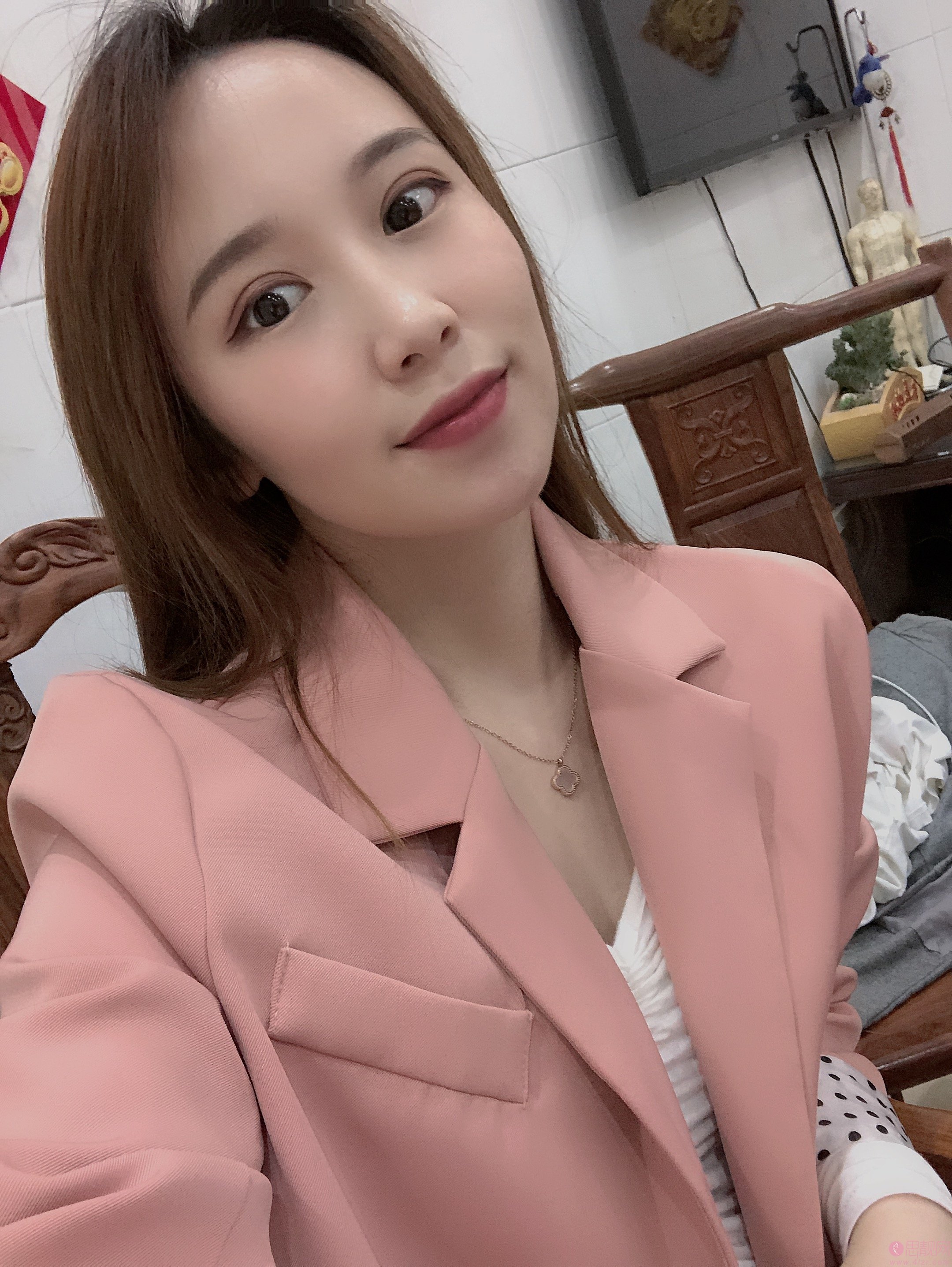 成都韩艺医学美容隆鼻怎么样？2020价格表一览+隆鼻真人分享案例