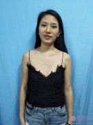 成都景华医学美容整形隆胸贵不贵？2020价格表一览+隆胸真人案例分享