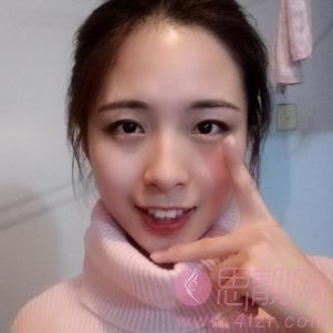 上海健丽医疗美容（原上海逆时针）李应激光祛眼袋怎么样？附祛眼袋前后对比案例及2020价格表一览