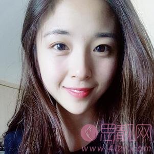 上海健丽医疗美容（原上海逆时针）李应激光祛眼袋怎么样？附祛眼袋前后对比案例及2020价格表一览