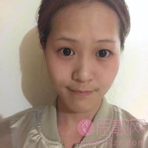 上海江城医疗美容吴霞激光祛红血丝怎么样？2020价格表曝光