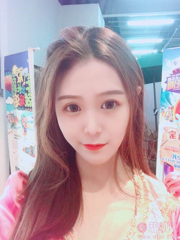 上海江城医疗美容吴霞激光祛红血丝怎么样？2020价格表曝光