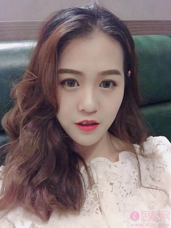 上海江城医疗美容吴霞激光祛红血丝怎么样？2020价格表曝光