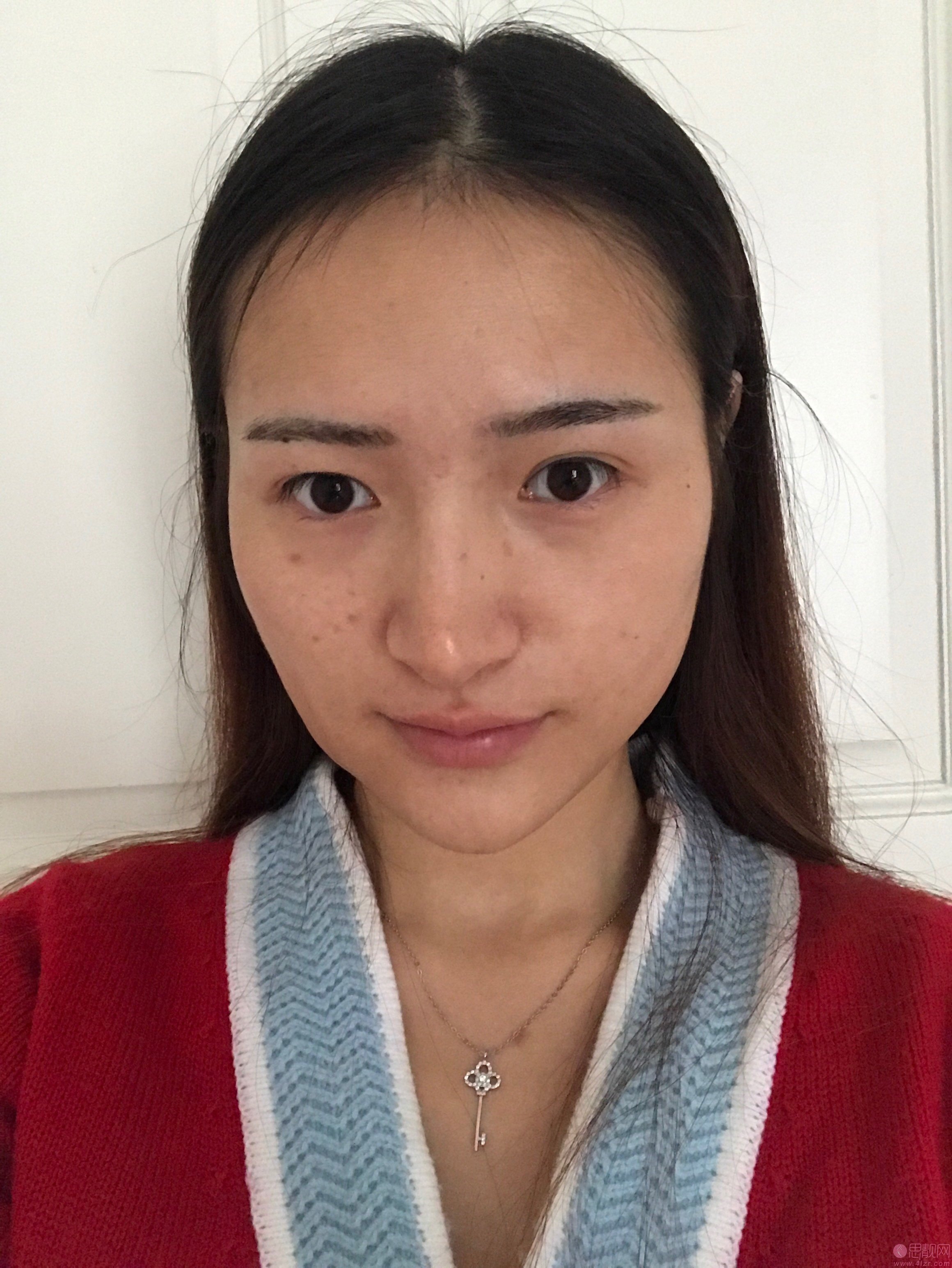 成都美立方（原成都华博）医疗美容整形医院祛斑多少钱？2020价格表曝光