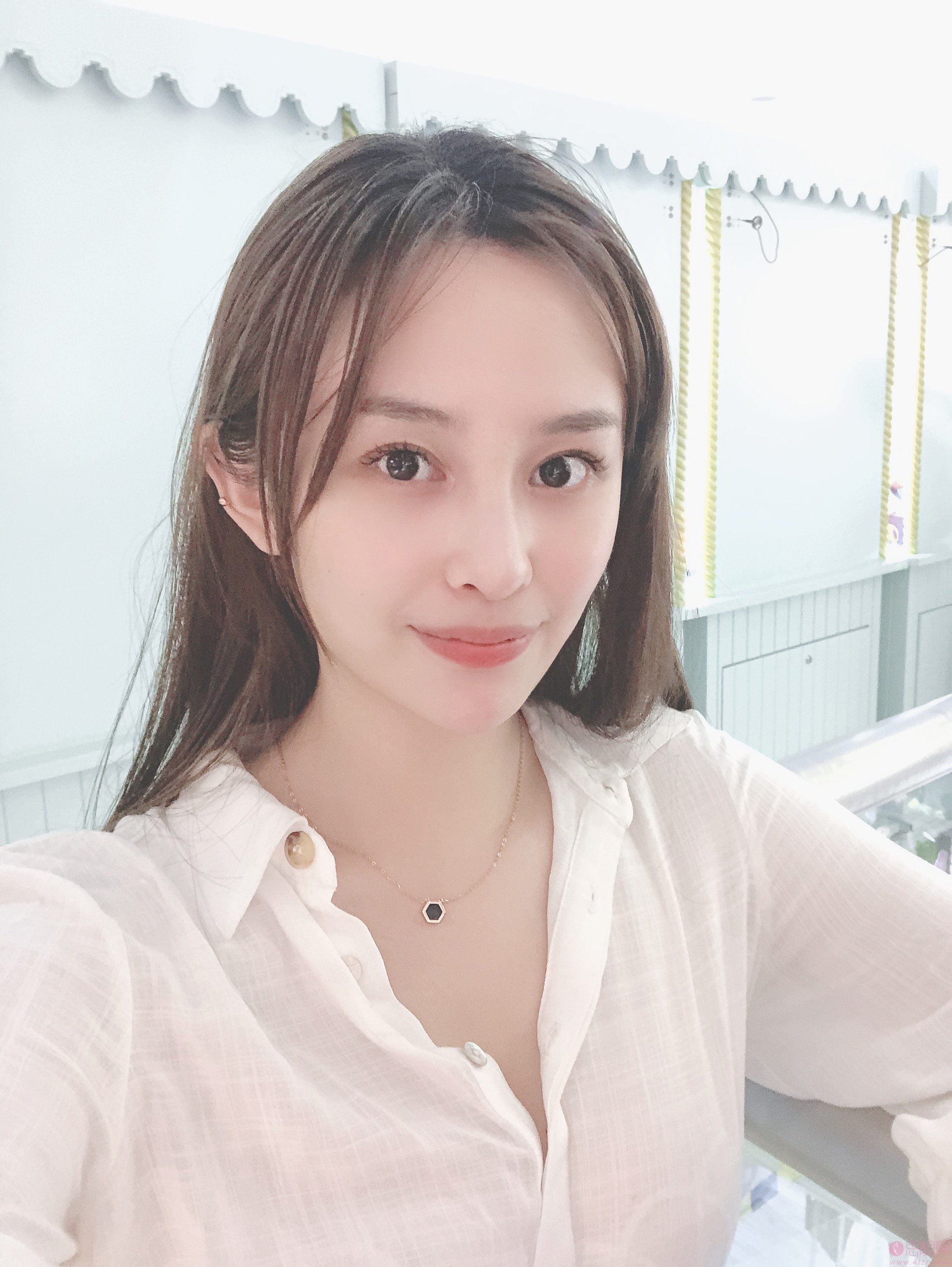 成都米亚医疗美容整形门诊部隆鼻多少钱？2020价格表曝光+隆鼻真人分享