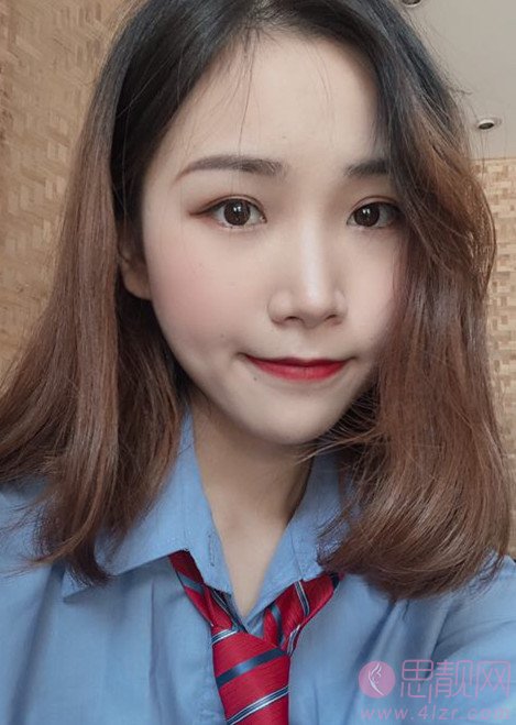 福州中意整形美容面部吸脂怎么样？2020价格表一览+吸脂瘦脸案例分享