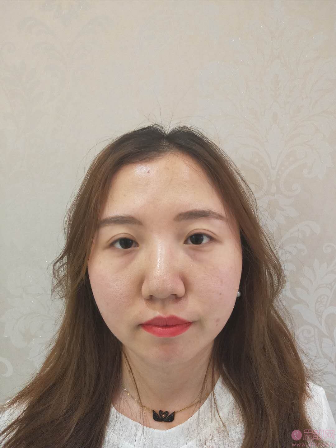 成都僮颜医疗美容祛眼袋怎么样？祛眼袋前后对比效果及2020价格表曝光