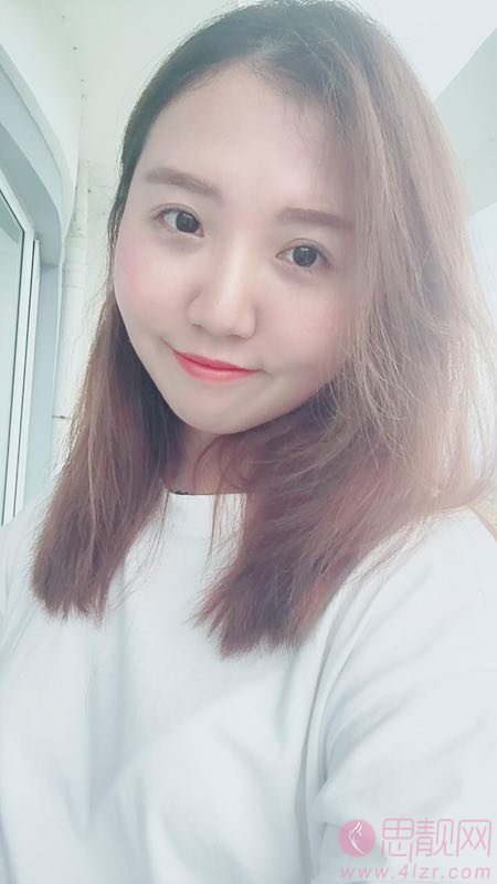 成都僮颜医疗美容祛眼袋怎么样？祛眼袋前后对比效果及2020价格表曝光
