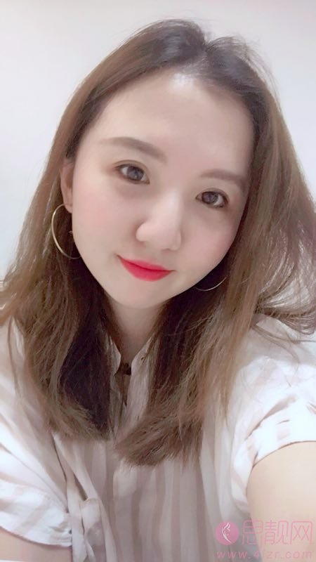 成都僮颜医疗美容祛眼袋怎么样？祛眼袋前后对比效果及2020价格表曝光