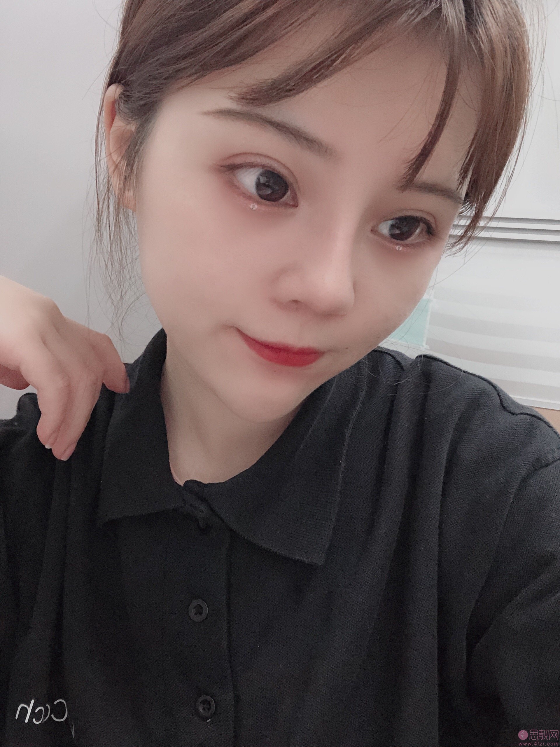 成都素美医疗美容卢元刚隆鼻怎么样？附隆鼻真人案例及2020价格表一览