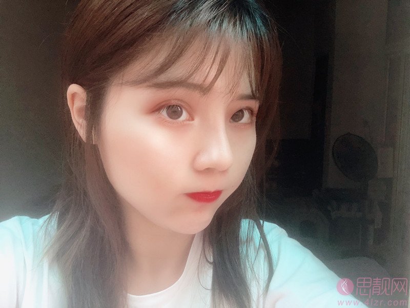 成都素美医疗美容卢元刚隆鼻怎么样？附隆鼻真人案例及2020价格表一览