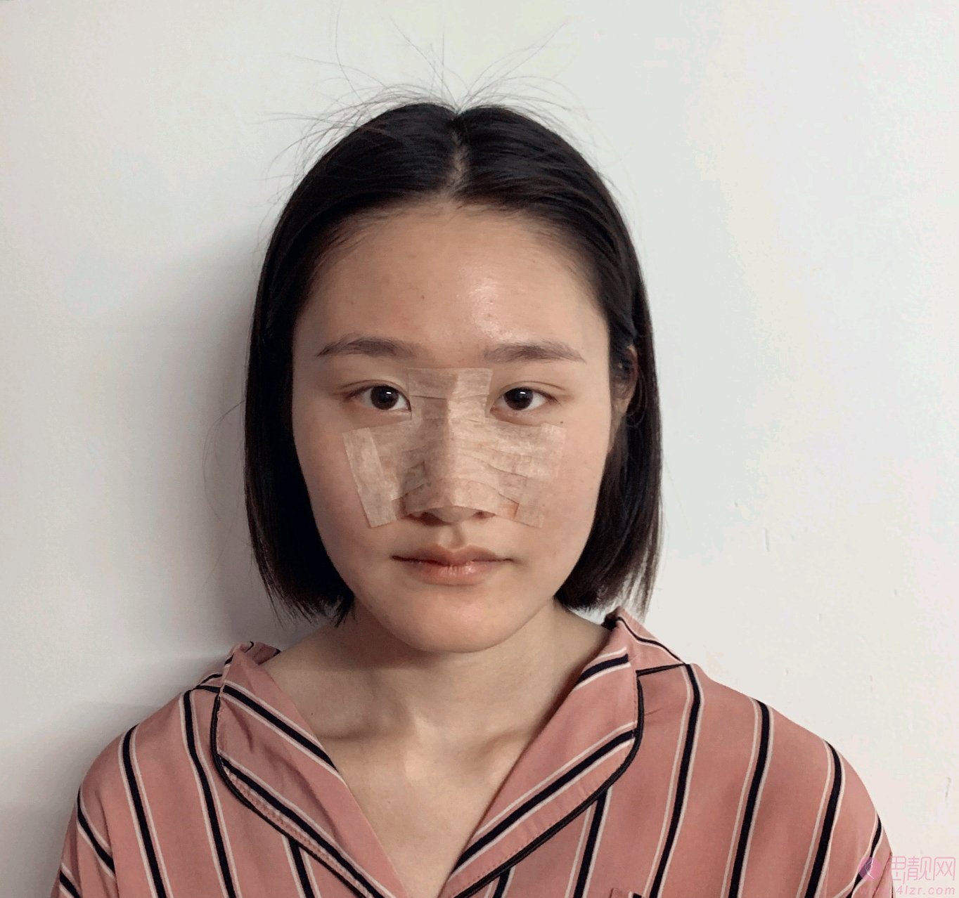上海诺诗雅医疗美容医院隆鼻好不好？附隆鼻真人分享及2020价格表一览