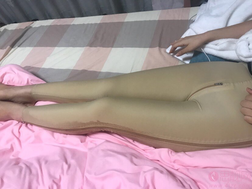 上海茸城医疗美容吸脂瘦大腿多少钱？2020价格表一览+吸脂瘦大腿真人案例分享