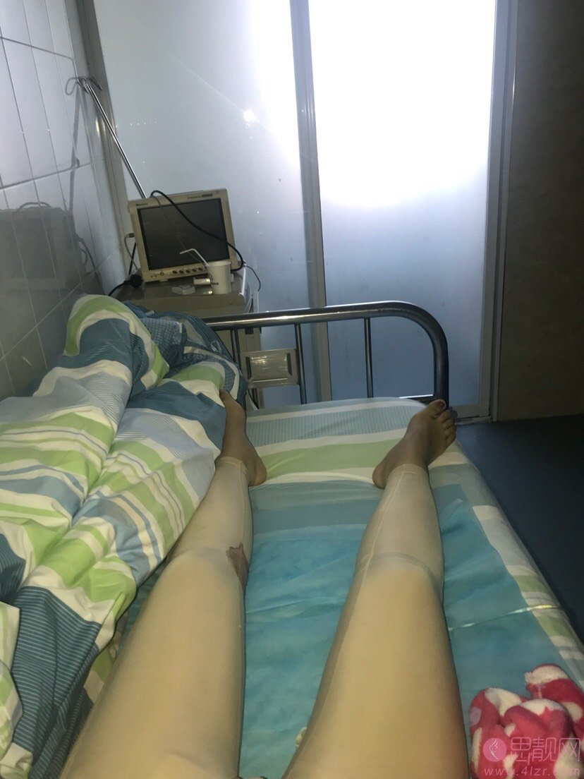上海茸城医疗美容吸脂瘦大腿多少钱？2020价格表一览+吸脂瘦大腿真人案例分享
