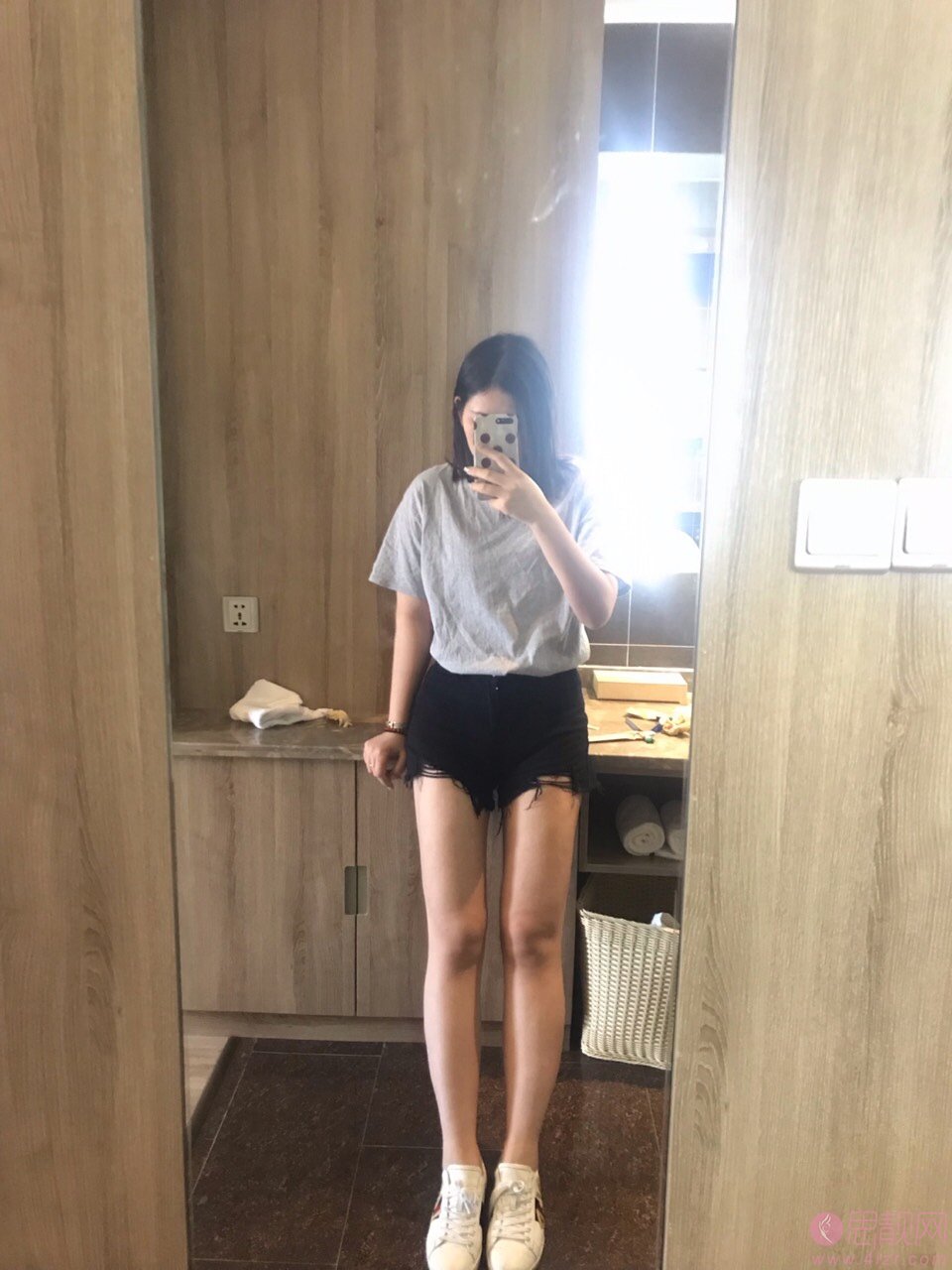 上海茸城医疗美容吸脂瘦大腿多少钱？2020价格表一览+吸脂瘦大腿真人案例分享