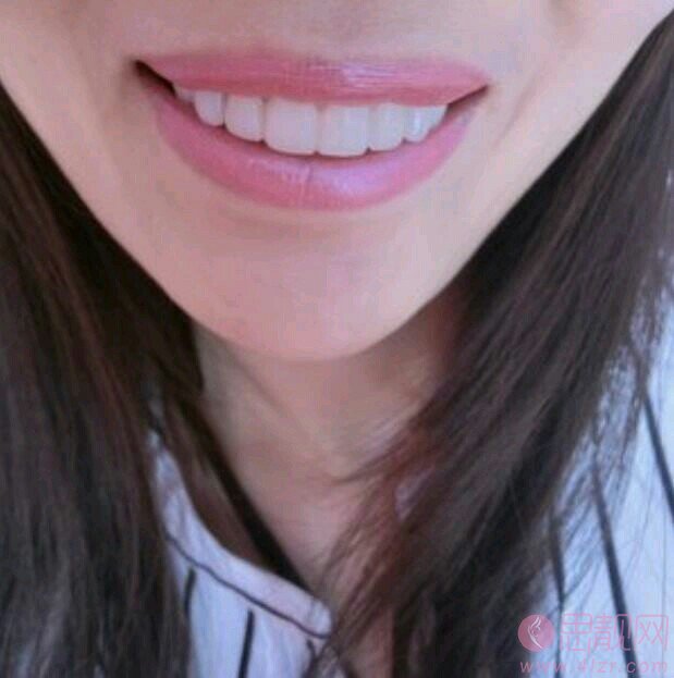 拜博口腔（珠海拱北门店）牙齿美白如何？2020价格表一览