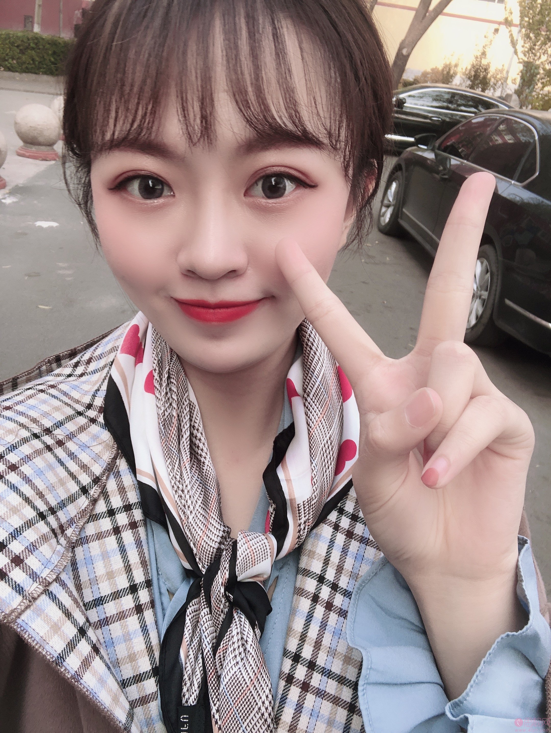 成都新颐美医疗美容做双眼皮多少钱？2020价格表曝光+双眼皮真人案例分享