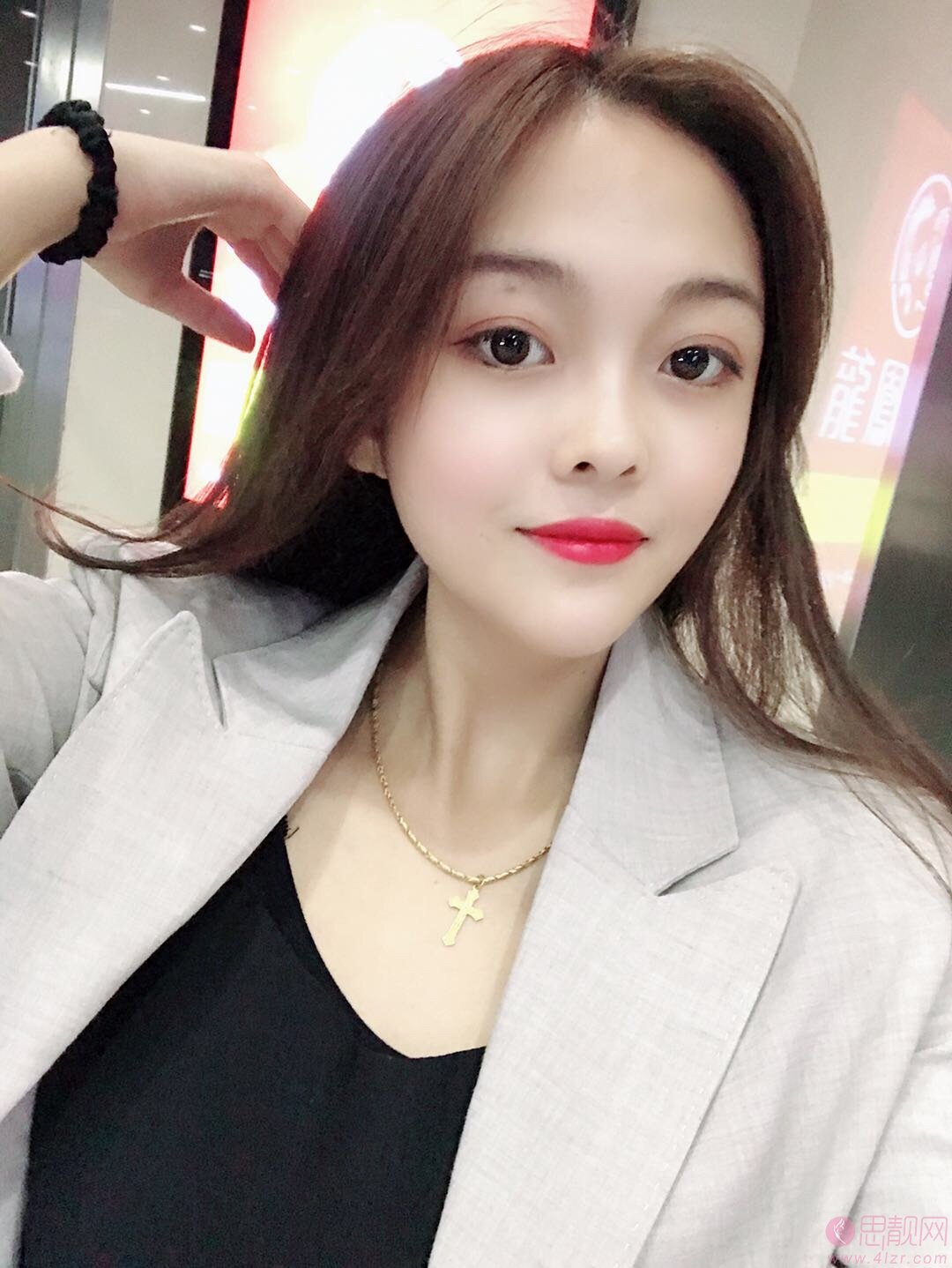 上海同济大学附属天佑医院医疗美容科切开双眼皮多少钱？2020价格表一览+双眼皮真人案例分享