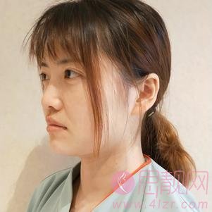 上海薇琳医疗美容医院曹芳隆鼻怎么样？2020价格表曝光+隆鼻真人案例分享