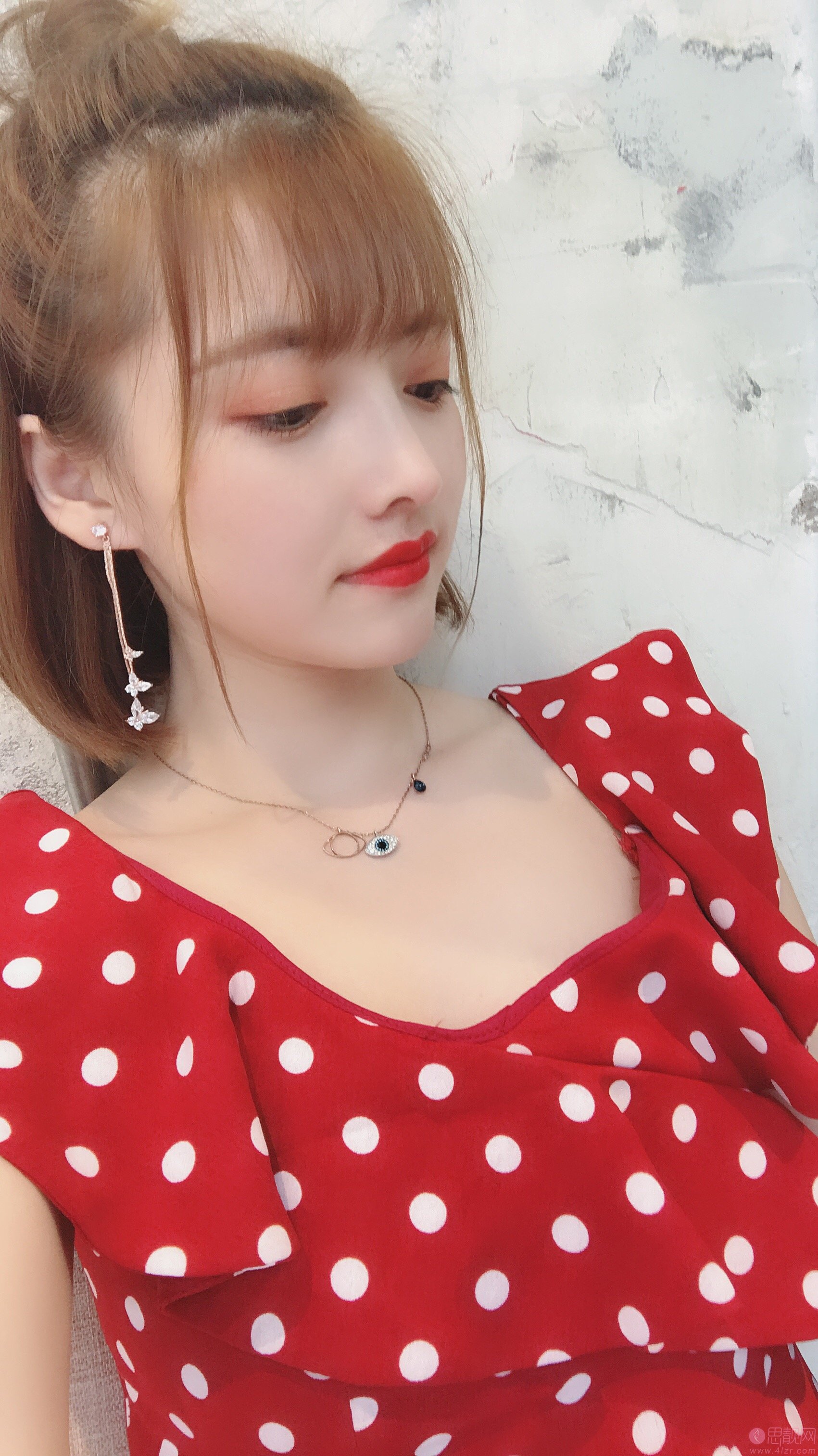 上海薇琳医疗美容医院曹芳隆鼻怎么样？2020价格表曝光+隆鼻真人案例分享