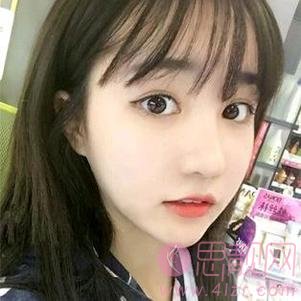 上海星采医疗美容门诊部隆鼻怎么样？2020价格表曝光+隆鼻真人案例分享