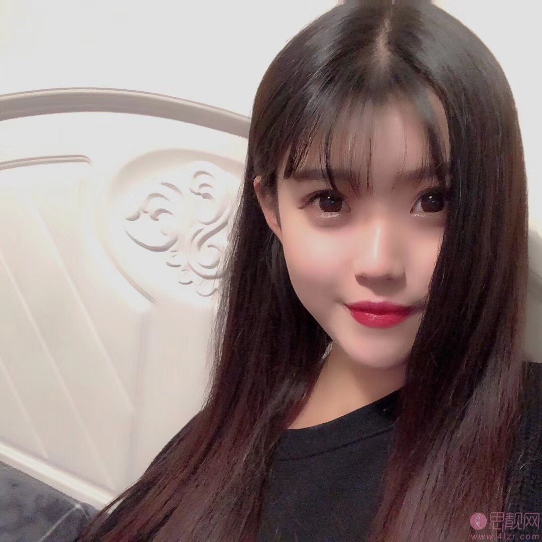 上海伊莱美医疗美容医院邱文苑隆鼻怎么样？2020价格表曝光+隆鼻真人案例分享