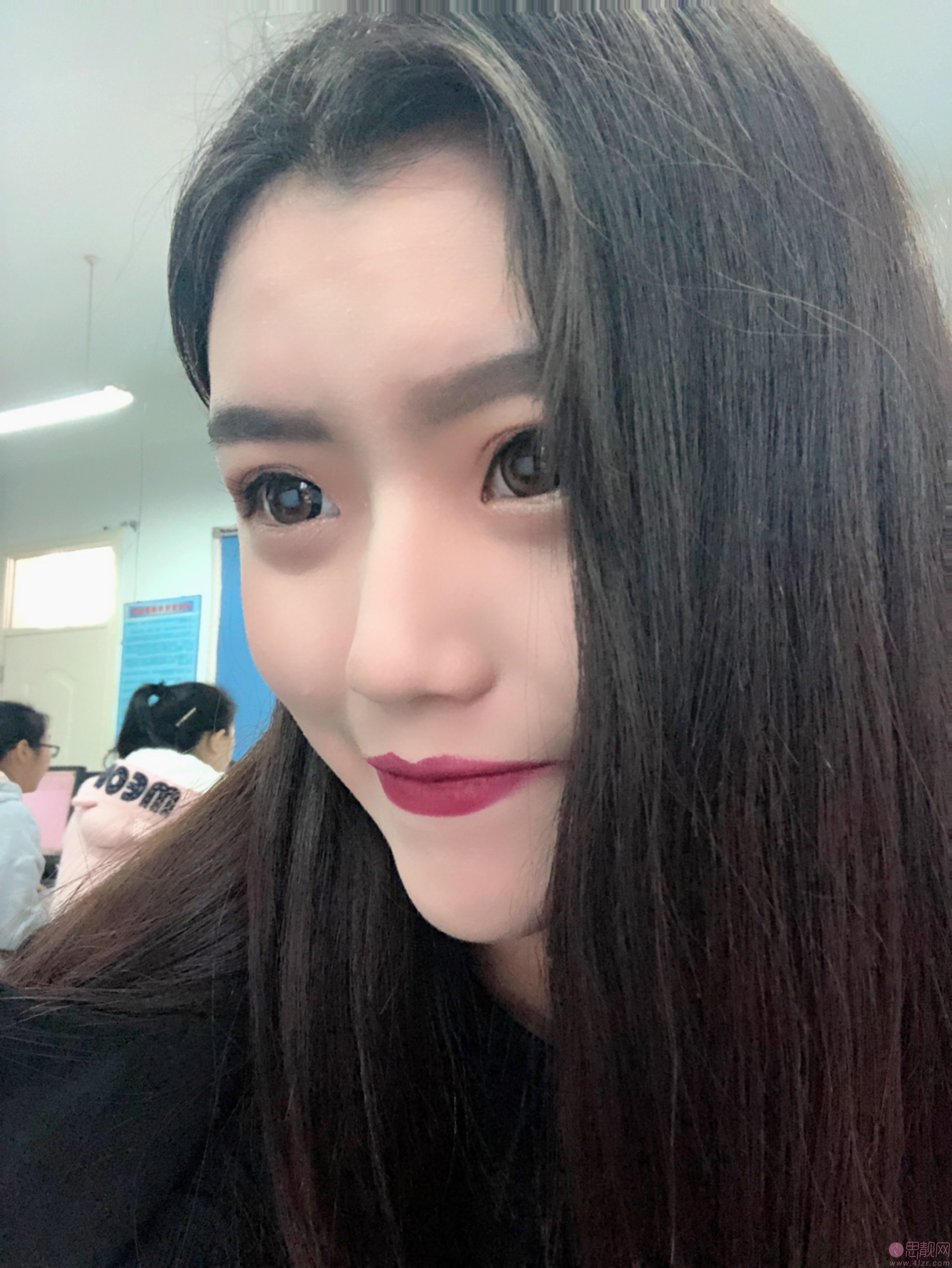 上海伊莱美医疗美容医院邱文苑隆鼻怎么样？2020价格表曝光+隆鼻真人案例分享