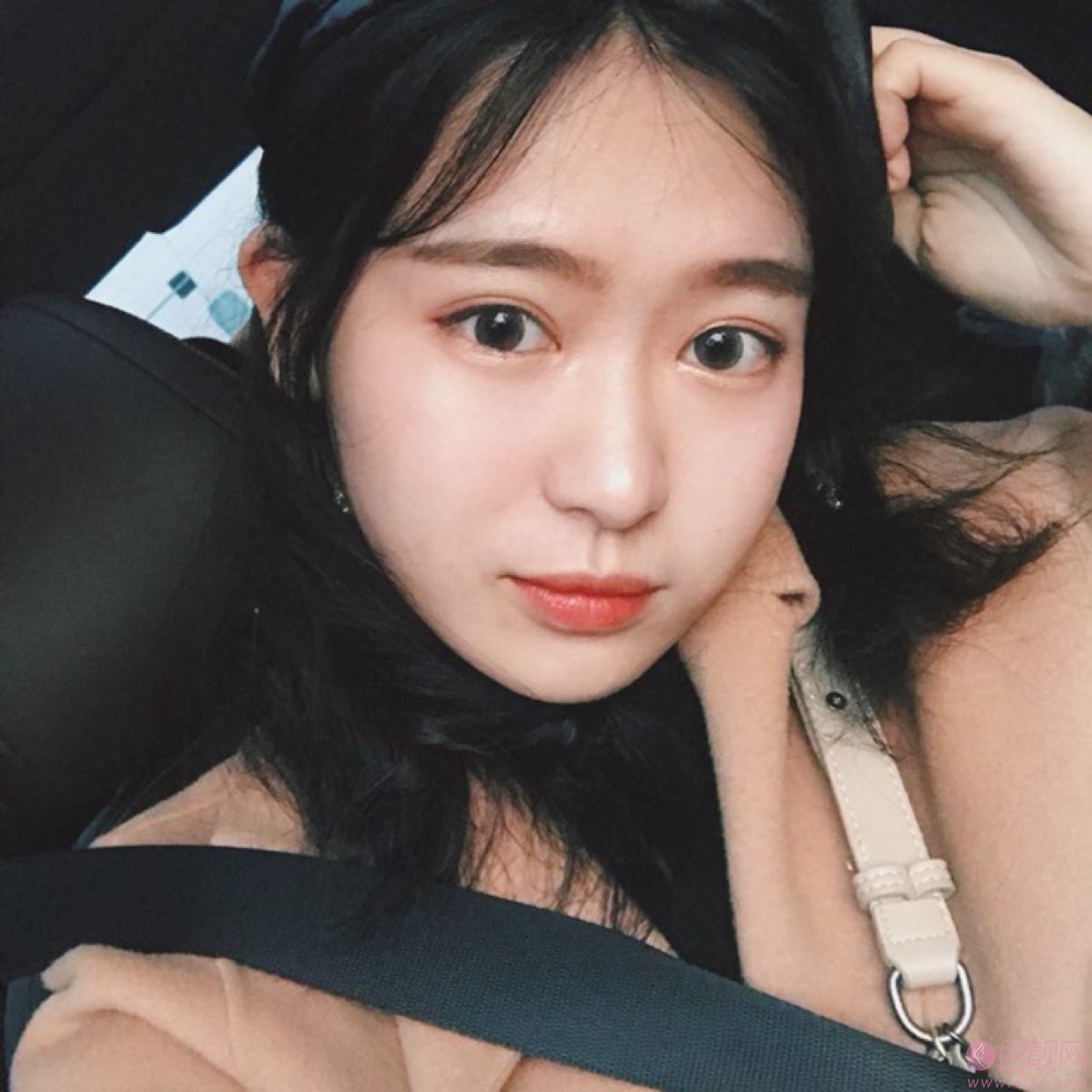 安徽医科大学第一附属医院整形美容中心做双眼皮怎么样？附双眼皮真人案例分享