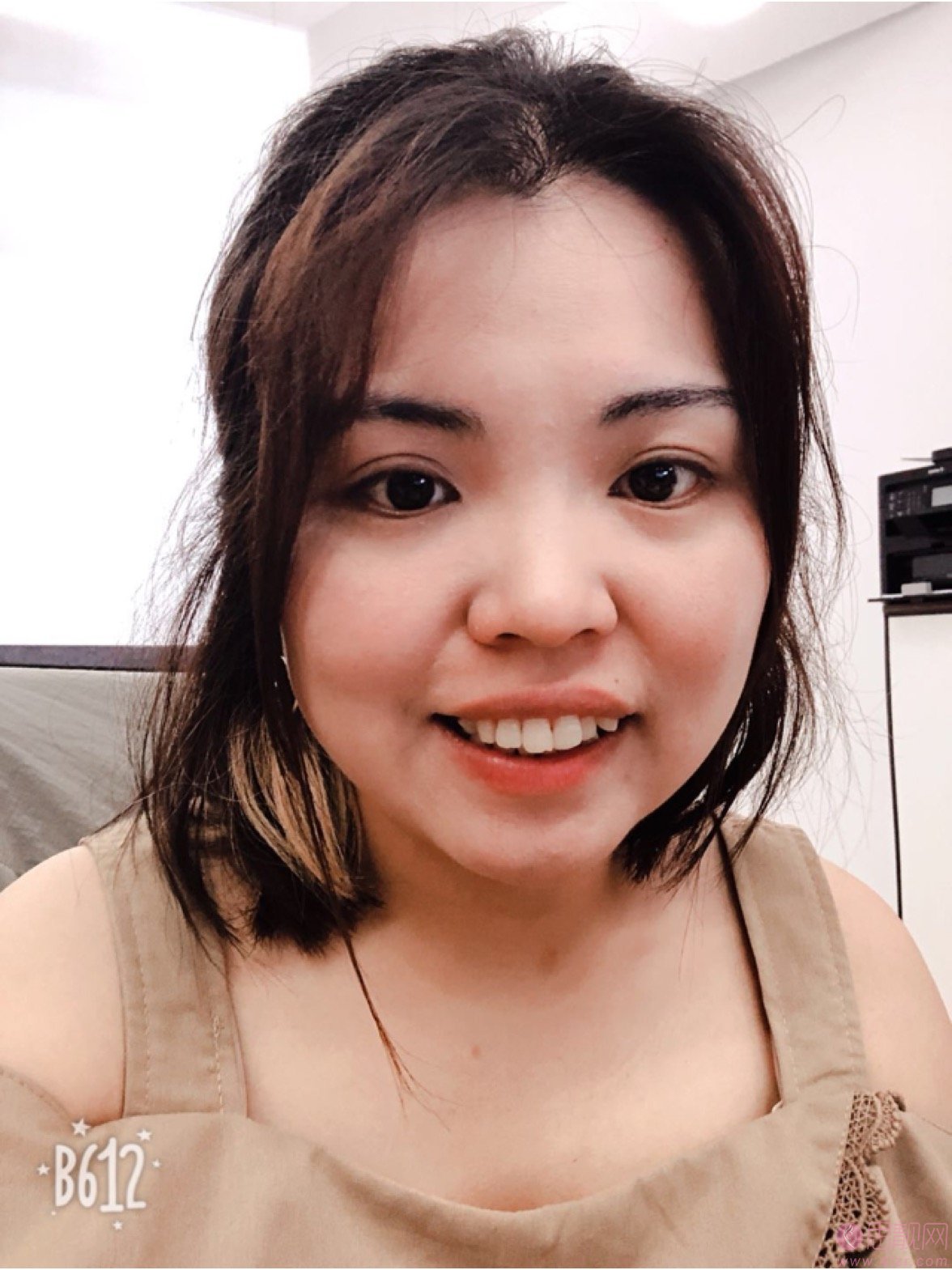 拜博口腔(洛阳景华路拜尔口腔门诊部)矫正牙齿好不好?2020价格表曝光