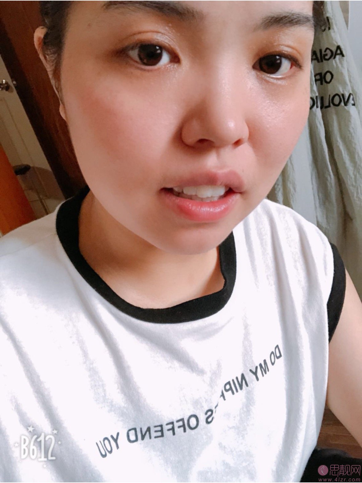 拜博口腔(洛阳景华路拜尔口腔门诊部)矫正牙齿好不好?2020价格表曝光