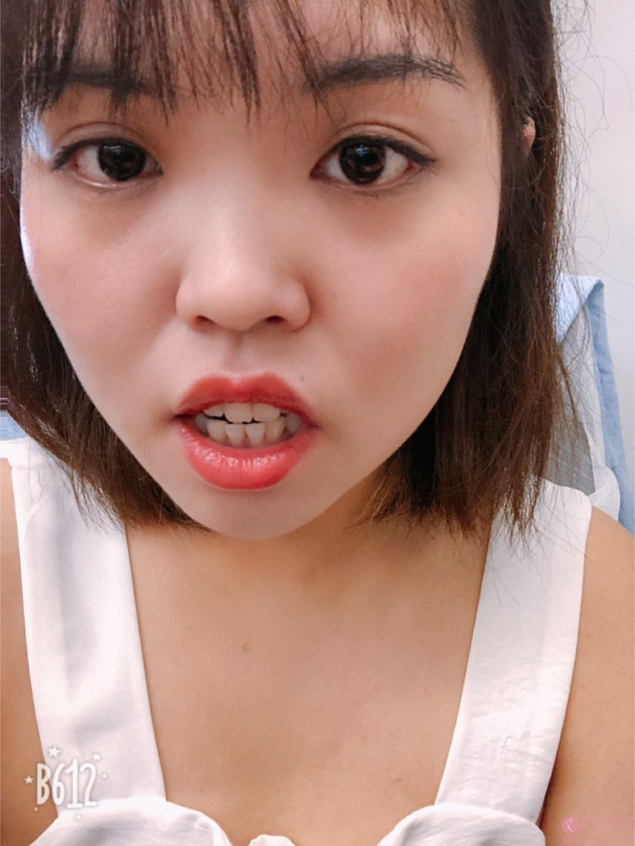 拜博口腔(洛阳景华路拜尔口腔门诊部)矫正牙齿好不好?2020价格表曝光